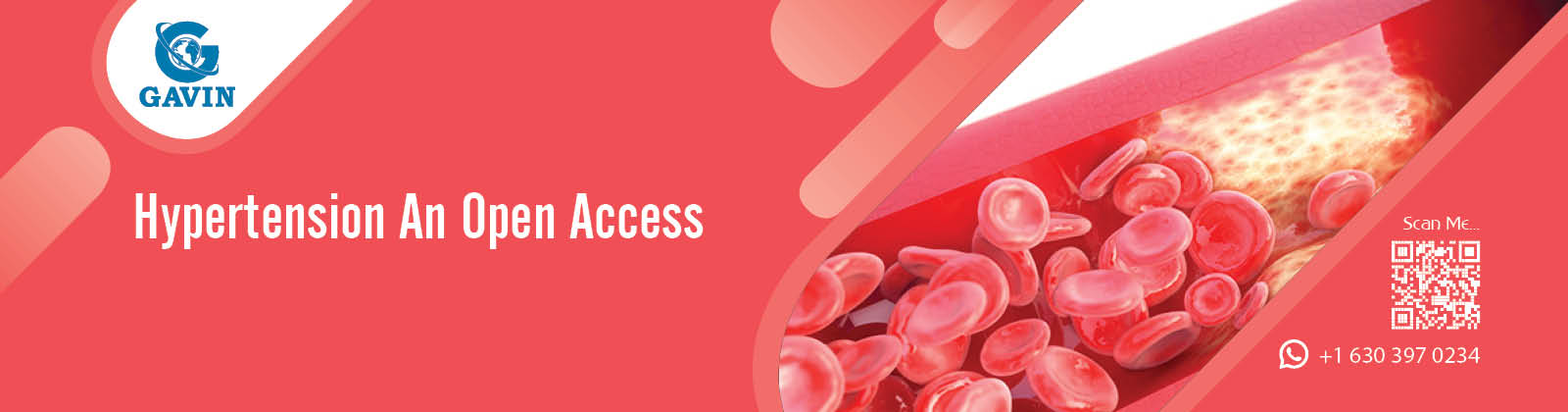 Hypertension 1